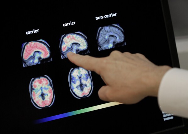 Reflecting upon racial disparities in dementia cases